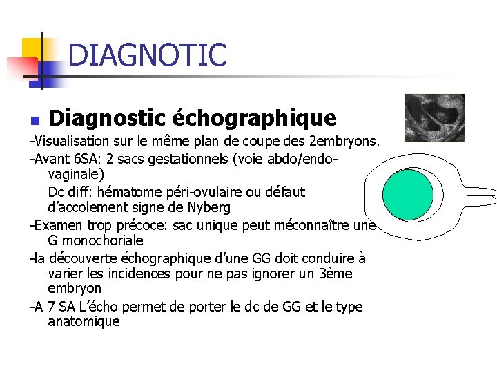 DIAGNOTIC Diagnostic échographique n -Visualisation sur le même plan de coupe des 2 embryons.
