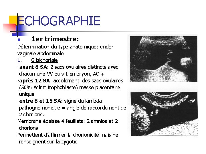 ECHOGRAPHIE n 1 er trimestre: Détermination du type anatomique: endovaginale, abdominale 1. G bichoriale: