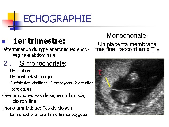 ECHOGRAPHIE n 1 er trimestre: Détermination du type anatomique: endovaginale, abdominale 2. G monochoriale: