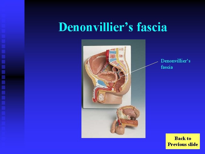 Denonvillier’s fascia Back to Previous slide 