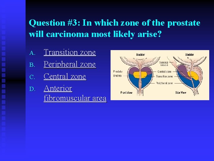 Question #3: In which zone of the prostate will carcinoma most likely arise? A.