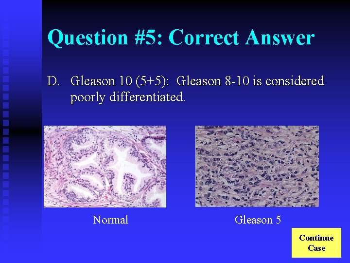 Question #5: Correct Answer D. Gleason 10 (5+5): Gleason 8 -10 is considered poorly