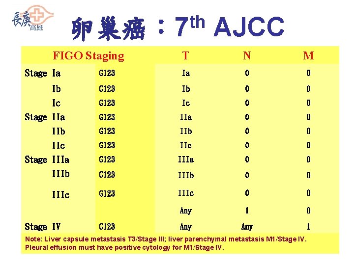 th 卵巢癌： 7 FIGO Staging AJCC T N M Stage Ia G 123 Ia