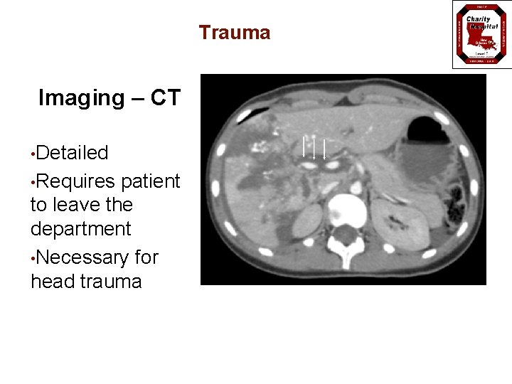 Trauma Imaging – CT • Detailed • Requires patient to leave the department •