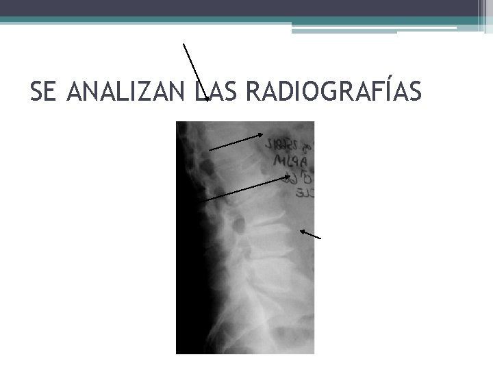 SE ANALIZAN LAS RADIOGRAFÍAS SE ANALIZAN LAS RADIOGRAFÍAS