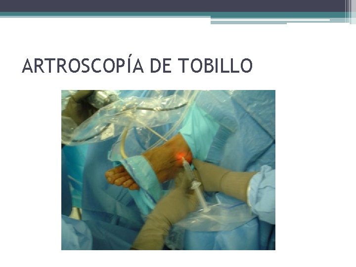 ARTROSCOPÍA DE TOBILLO ARTROSCOPÍA DE TOBILLO