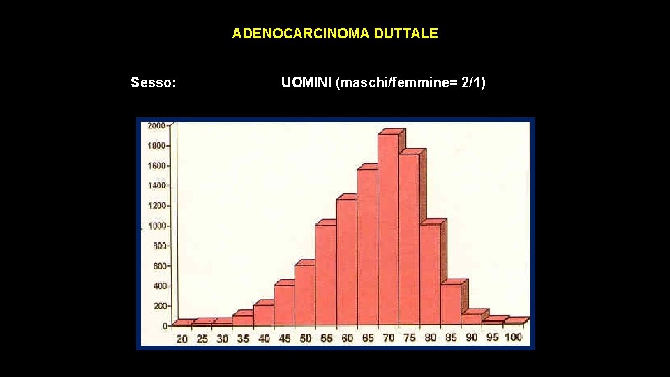 ADENOCARCINOMA DUTTALE Sesso: UOMINI (maschi/femmine= 2/1) ADENOCARCINOMA DUTTALE Sesso: UOMINI (maschi/femmine= 2/1)