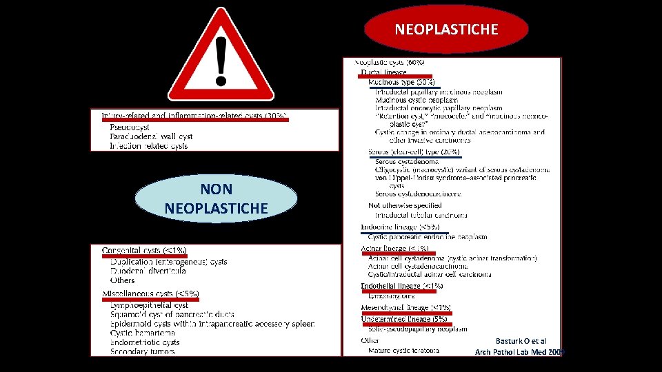 NEOPLASTICHE NON NEOPLASTICHE Basturk O et al Arch Pathol Lab Med 2009 NEOPLASTICHE NON NEOPLASTICHE Basturk O et al Arch Pathol Lab Med 2009