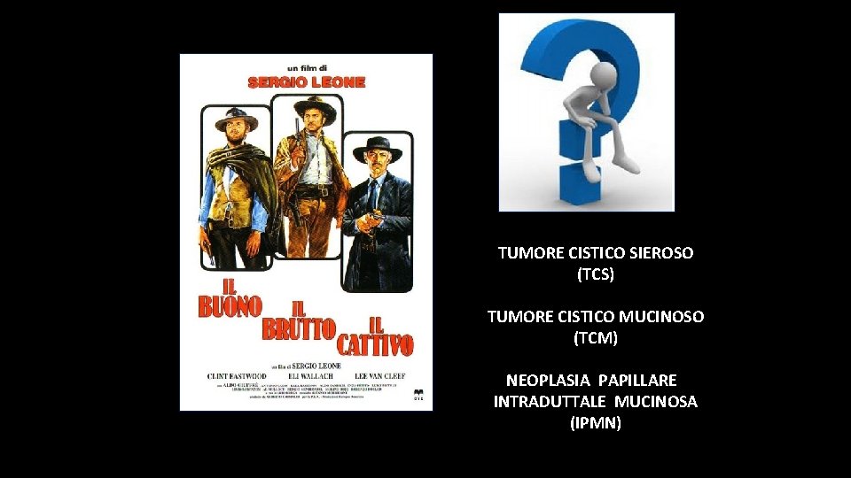 TUMORE CISTICO SIEROSO (TCS) TUMORE CISTICO MUCINOSO (TCM) NEOPLASIA PAPILLARE INTRADUTTALE MUCINOSA (IPMN) TUMORE CISTICO SIEROSO (TCS) TUMORE CISTICO MUCINOSO (TCM) NEOPLASIA PAPILLARE INTRADUTTALE MUCINOSA (IPMN)