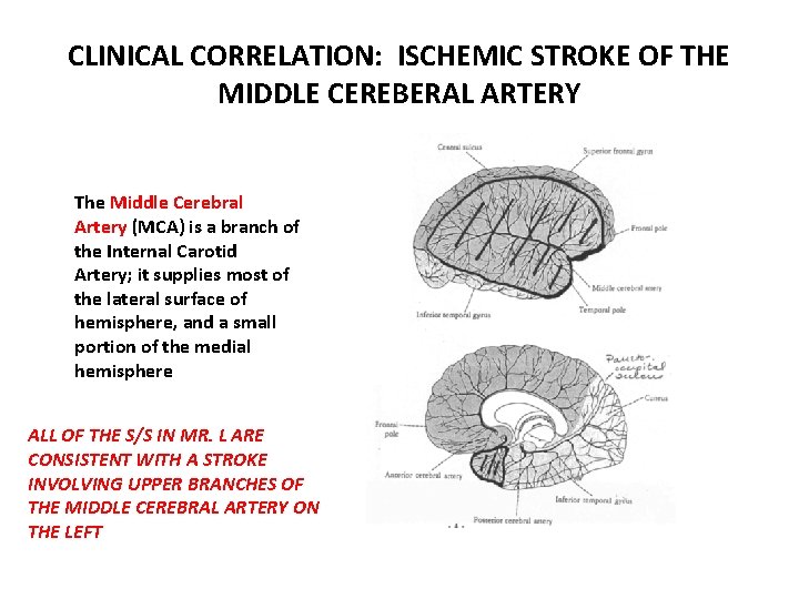 CLINICAL CORRELATION: ISCHEMIC STROKE OF THE MIDDLE CEREBERAL ARTERY The Middle Cerebral Artery (MCA)