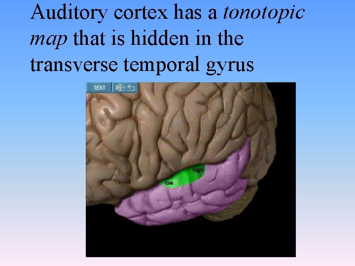 Auditory cortex has a tonotopic map that is hidden in the transverse temporal gyrus