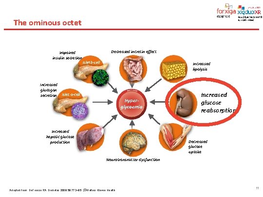 The ominous octet Impaired insulin secretion Decreased incretin effect Islet b-cell Increased lipolysis Increased