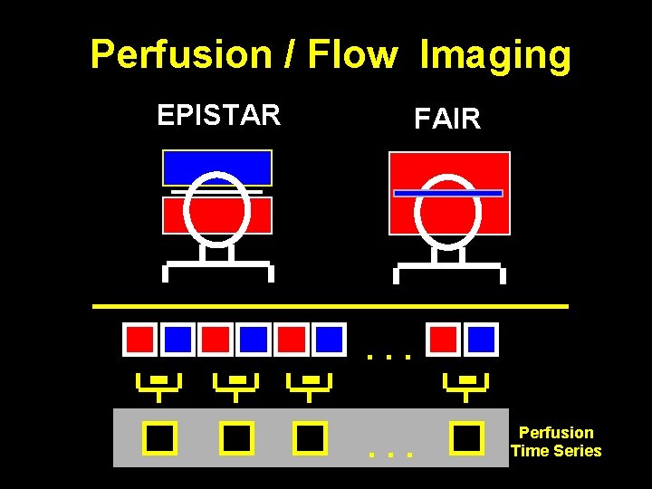 Perfusion / Flow Imaging EPISTAR - - - FAIR . . . Perfusion Time