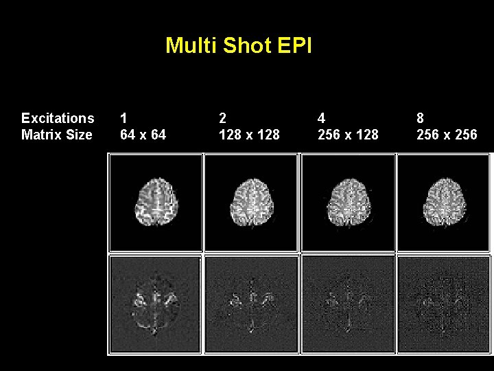 Multi Shot EPI Excitations Matrix Size 1 64 x 64 2 128 x 128