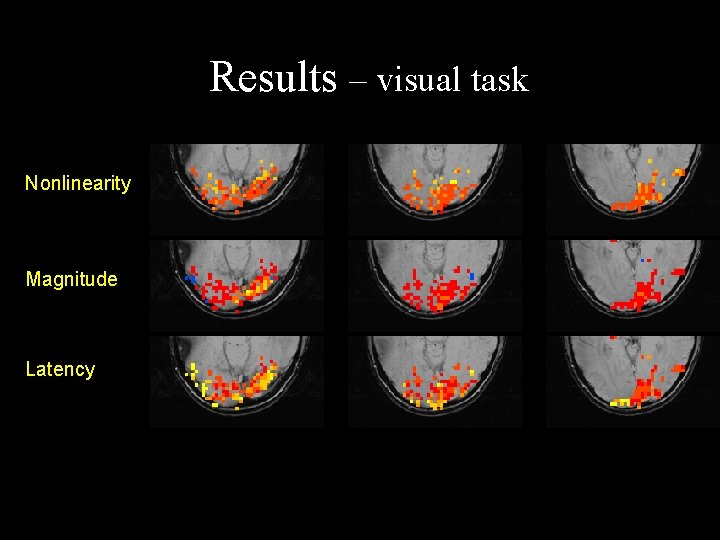 Results – visual task Nonlinearity Magnitude Latency 