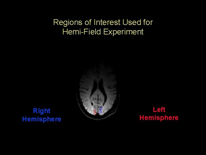 Regions of Interest Used for Hemi-Field Experiment Right Hemisphere Left Hemisphere 