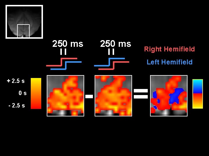 250 ms Right Hemifield Left Hemifield + 2. 5 s 0 s - 2.