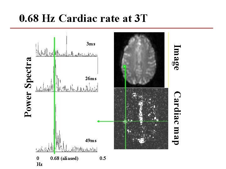 0. 68 Hz Cardiac rate at 3 T Power Spectra Image 3 ms 26