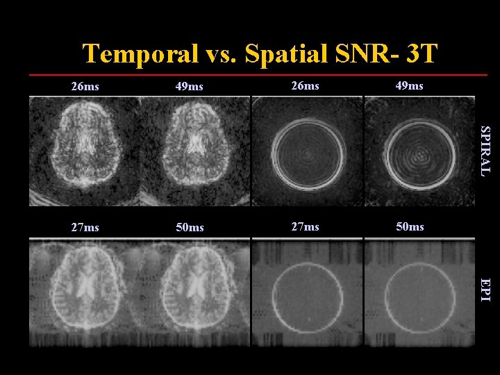 Temporal vs. Spatial SNR- 3 T 49 ms 26 ms 49 ms 27 ms