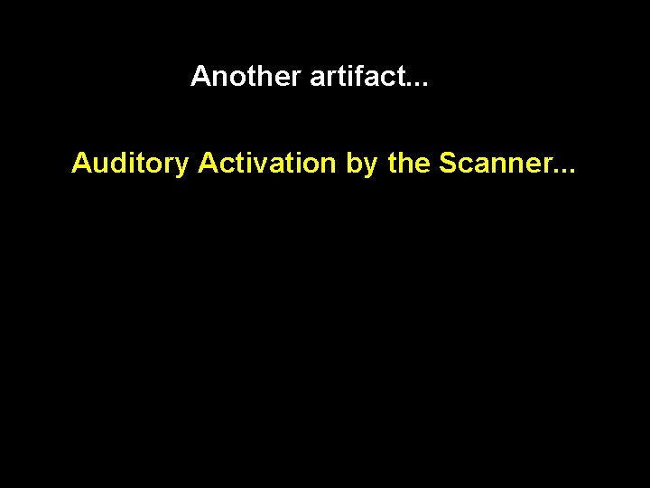 Another artifact. . . Auditory Activation by the Scanner. . . 