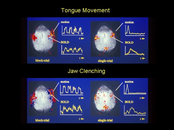 Tongue Movement Jaw Clenching 