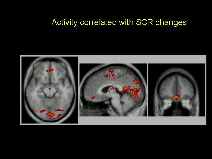 Activity correlated with SCR changes 