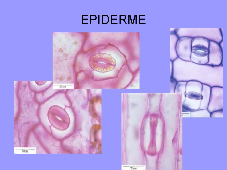 EPIDERME 