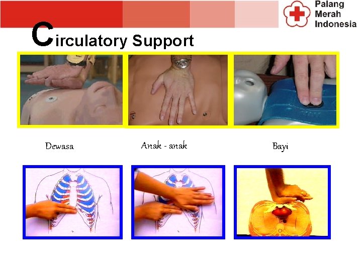 Circulatory Support Dewasa Anak - anak Bayi Circulatory Support Dewasa Anak - anak Bayi