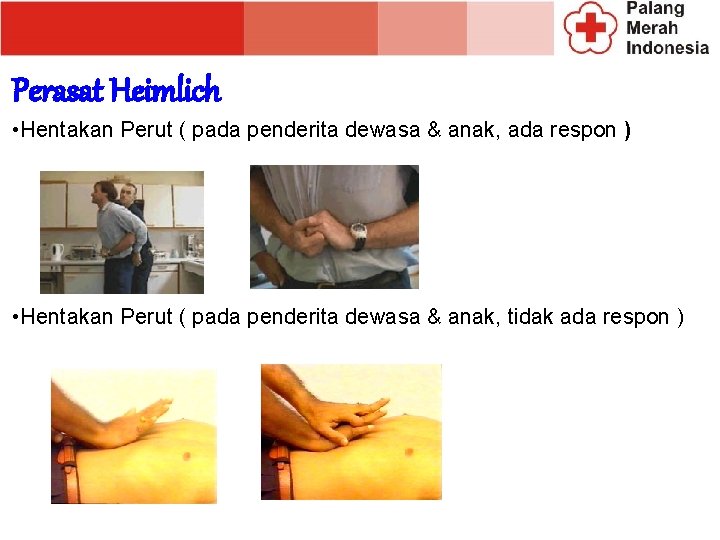Perasat Heimlich • Hentakan Perut ( pada penderita dewasa & anak, ada respon ) Perasat Heimlich • Hentakan Perut ( pada penderita dewasa & anak, ada respon )