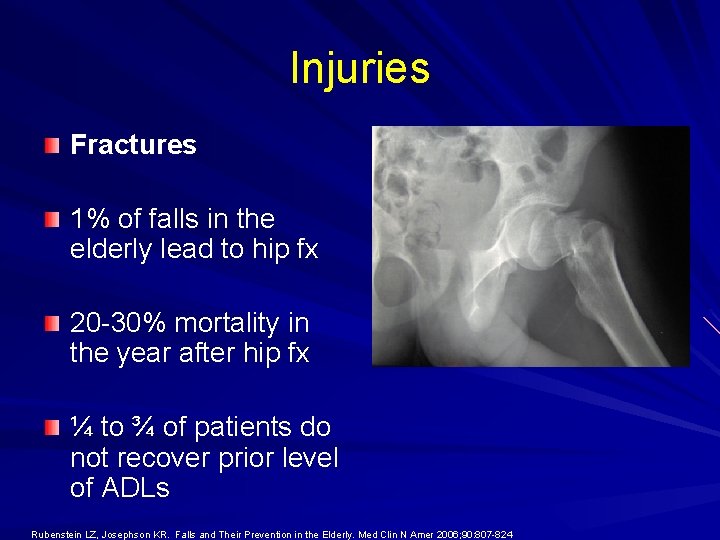 Injuries Fractures 1% of falls in the elderly lead to hip fx 20 -30%