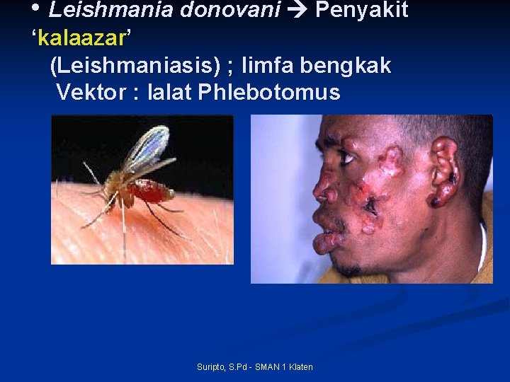  • Leishmania donovani Penyakit ‘kalaazar’ (Leishmaniasis) ; limfa bengkak Vektor : lalat Phlebotomus