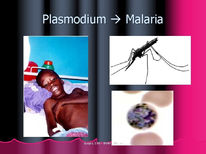 Plasmodium Malaria Suripto, S. Pd - SMAN 1 Klaten 