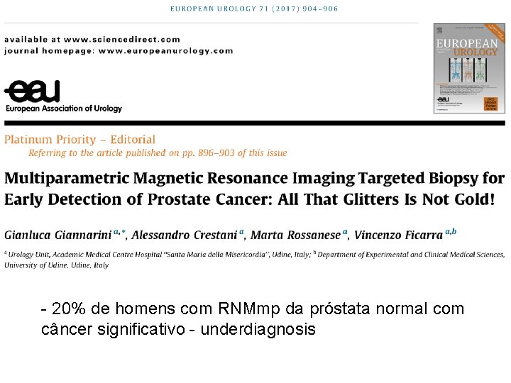 - 20% de homens com RNMmp da próstata normal com câncer significativo - underdiagnosis