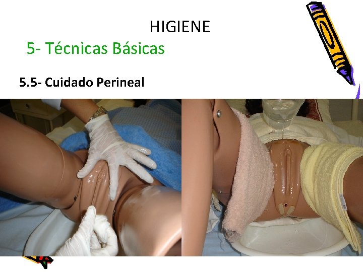 HIGIENE 5 - Técnicas Básicas 5. 5 - Cuidado Perineal 