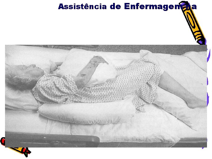 Assistência de Enfermagem na 