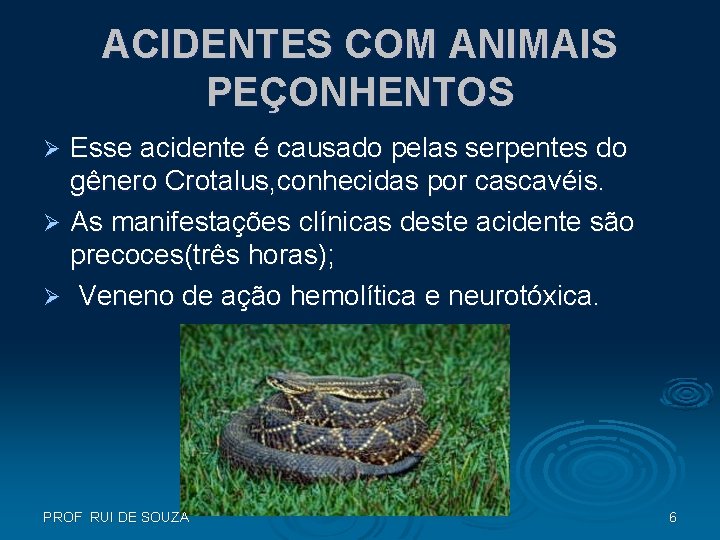 ACIDENTES COM ANIMAIS PEÇONHENTOS Esse acidente é causado pelas serpentes do gênero Crotalus, conhecidas ACIDENTES COM ANIMAIS PEÇONHENTOS Esse acidente é causado pelas serpentes do gênero Crotalus, conhecidas