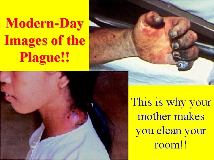 Modern-Day Images of the Plague!! This is why your mother makes you clean your