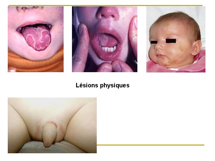 Lésions physiques 