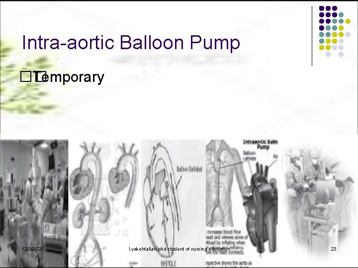 Intra-aortic Balloon Pump �� Temporary 12/3/2020 l. yekehfallah-phd student of nursing education 23 