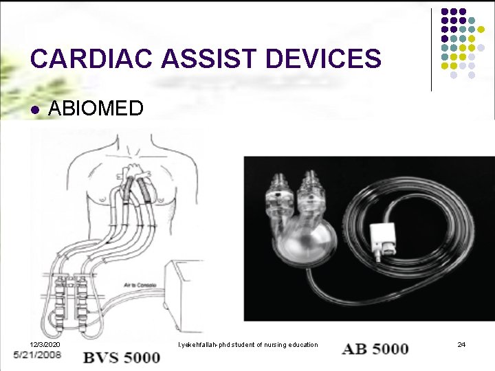 CARDIAC ASSIST DEVICES l ABIOMED 12/3/2020 l. yekehfallah-phd student of nursing education 24 