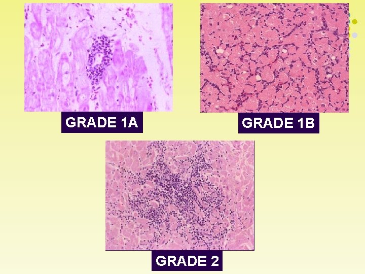 GRADE 1 A GRADE 1 B GRADE 2 