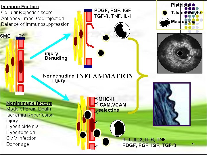 Immune Factors Cellular Rejection score Antibody –mediated rejection Balance of Immunosuppression SMC PDGF, FGF,