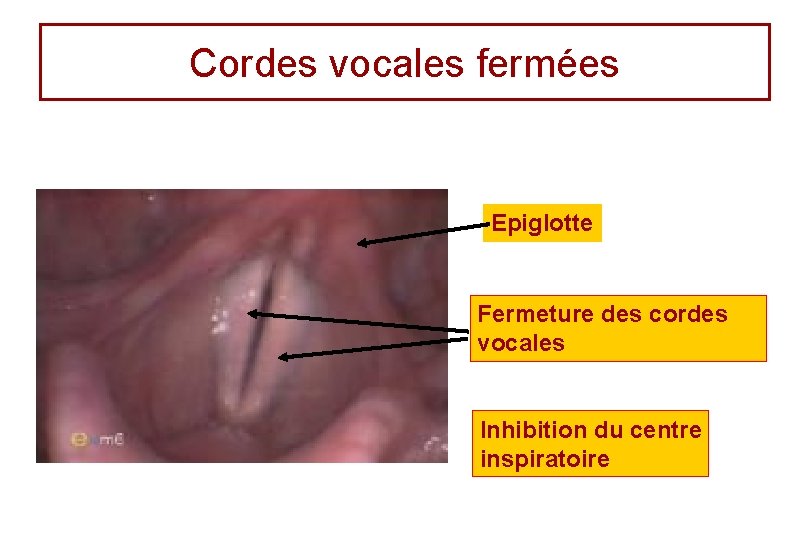 Cordes vocales fermées Epiglotte Fermeture des cordes vocales Inhibition du centre inspiratoire 