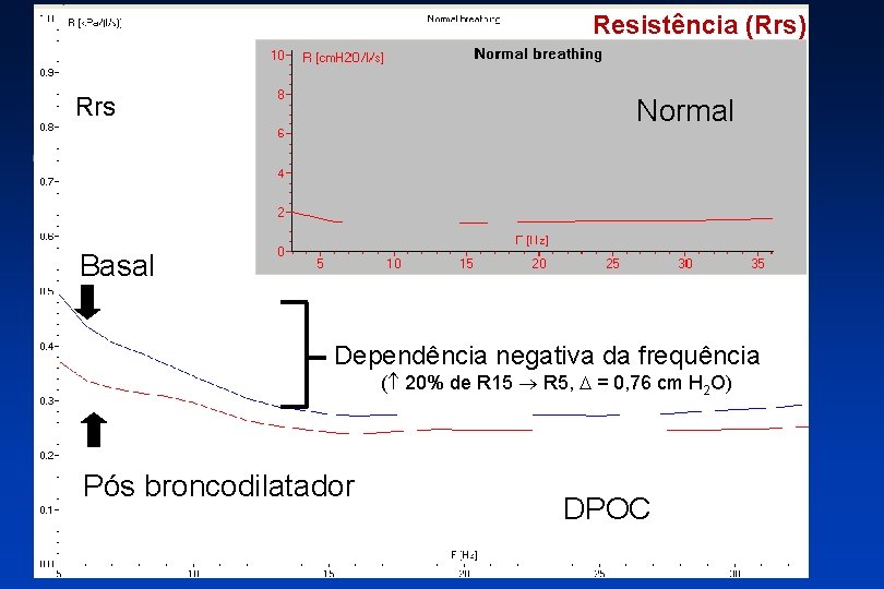 Resistência (Rrs) Rrs Normal Basal Dependência negativa da frequência ( 20% de R 15