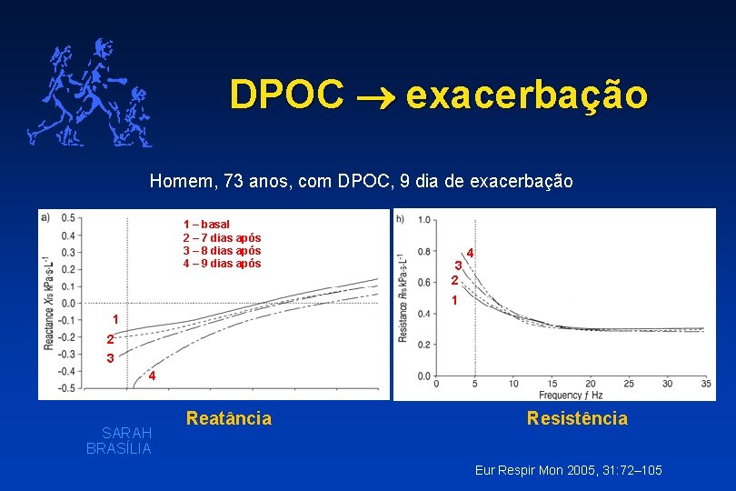 DPOC exacerbação Homem, 73 anos, com DPOC, 9 dia de exacerbação 1 – basal