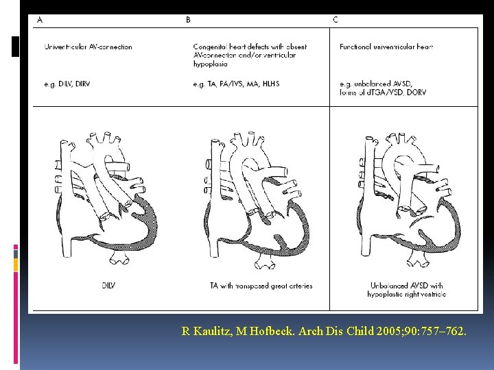 R Kaulitz, M Hofbeck. Arch Dis Child 2005; 90: 757– 762. 