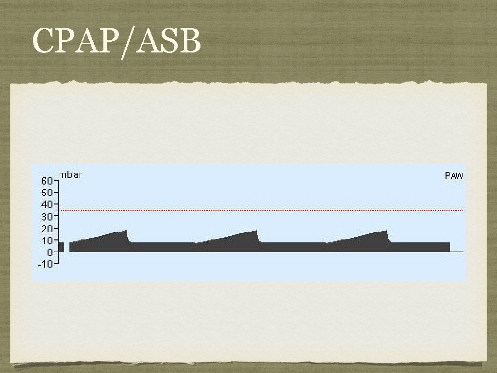 CPAP/ASB 