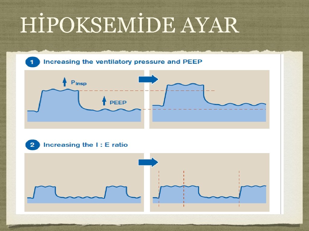 HİPOKSEMİDE AYAR HİPOKSEMİDE AYAR