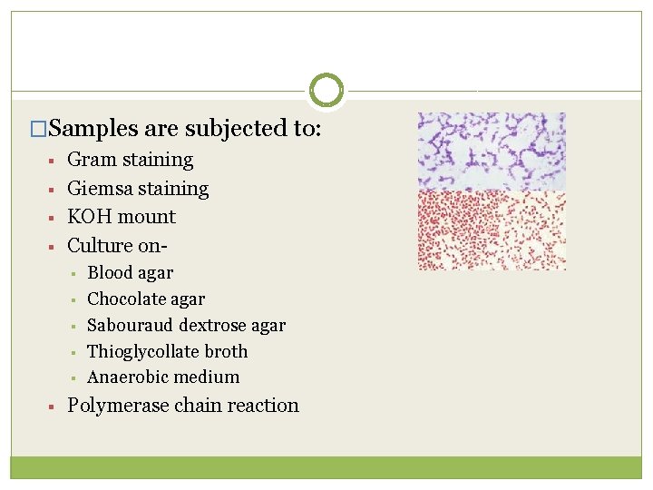 �Samples are subjected to: § § Gram staining Giemsa staining KOH mount Culture on§