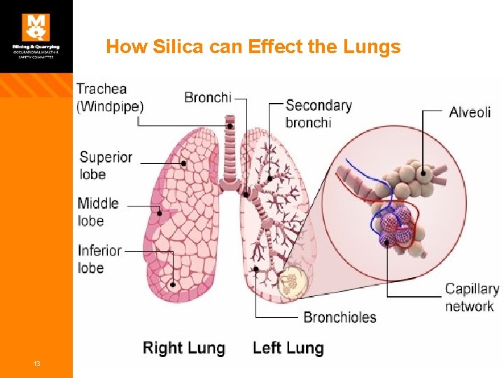 How Silica can Effect the Lungs 13 